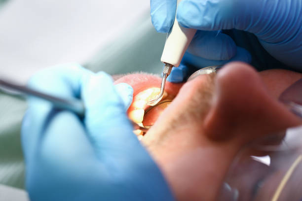 Best Emergency Denture Repair in Jamestown, OH