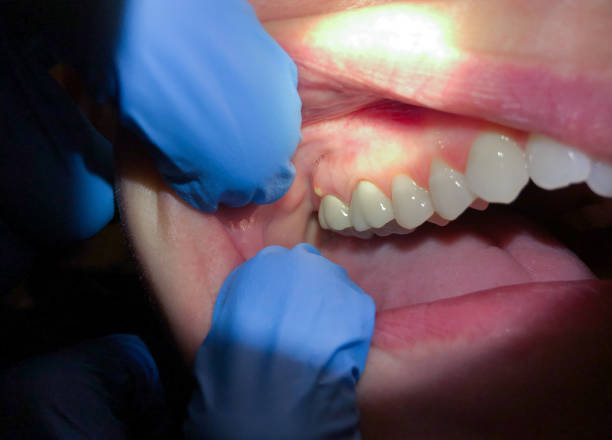 Best Weekend Emergency Dentist in Jamestown, OH