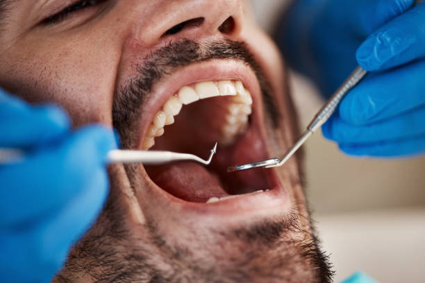 Best Same-Day Emergency Dental Services in Jamestown, OH