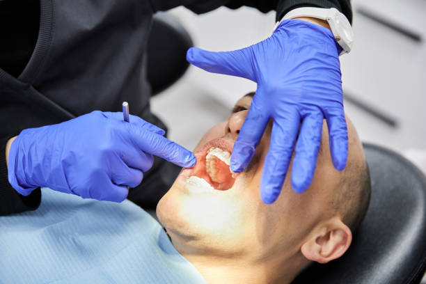 Best After-Hours Dental Trauma Care in Jamestown, OH