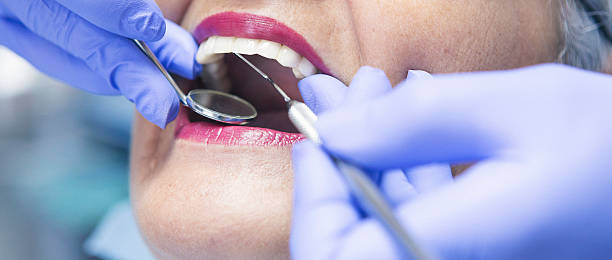 Best Emergency Treatment for Dental Infections or Abscesses in Jamestown, OH